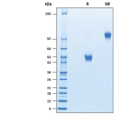 Recombinant Human CD3 delta/CD3d Fc Chimera Protein SDS-PAGE