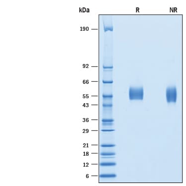 Recombinant Human TEM5/GPR124 His-tag Protein SDS-PAGE