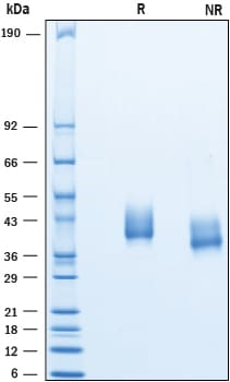 Recombinant Human TEM8/ANTXR1 His-tag Protein SDS-PAGE