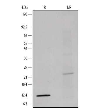 Human TGF-beta 1 Protein SDS-PAGE