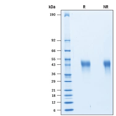 Recombinant Human TIM-3 His-tag Protein SDS-PAGE