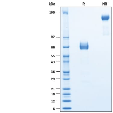 Recombinant Rat TIM-3 Fc Chimera Protein SDS-PAGE