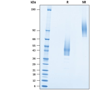 Recombinant Human TMEM119 Fc Chimera Protein SDS-PAGE