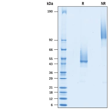 Recombinant Mouse TMEM119 Fc Chimera Protein SDS-PAGE
