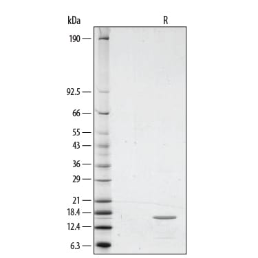 Recombinant Human TNF-alpha GMP Protein SDS-PAGE