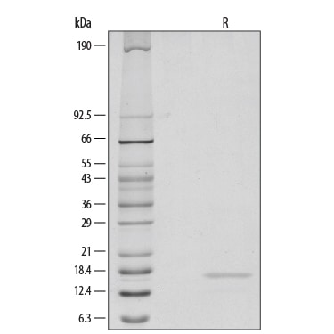 Recombinant Human TNF-alpha Protein SDS-PAGE