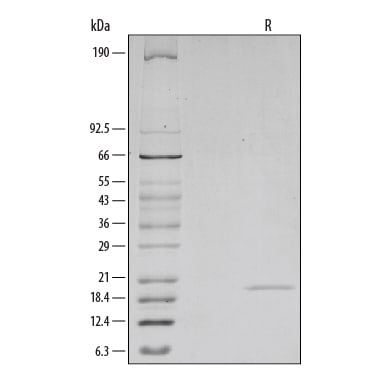 Recombinant Mouse TRANCE/RANK L/TNFSF11 (E. coli-expressed) SDS-PAGE