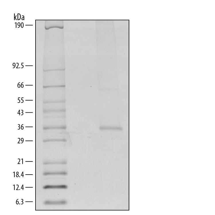 Recombinant Mouse TRANCE/RANK L/TNFSF11 Protein SDS-PAGE