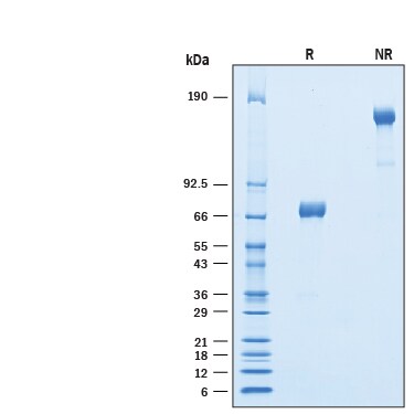Recombinant Mouse TREML4/TLT-4 Fc Chimera Protein SDS-PAGE