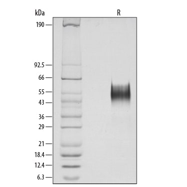 Recombinant Human Thrombopoietin Protein SDS-PAGE