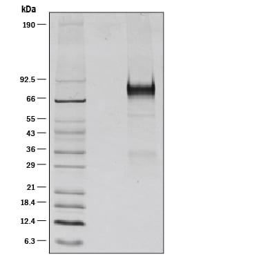 Recombinant Mouse Thrombopoietin Protein SDS-PAGE