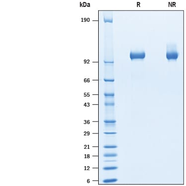 Recombinant Cynomolgus Monkey Tie-2 His-tag Protein SDS-PAGE