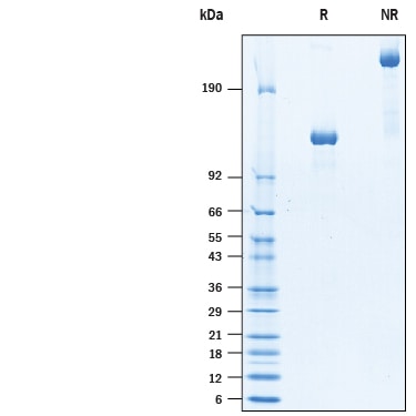 Recombinant Cynomolgus Monkey Tie-2 Fc Chimera Protein SDS-PAGE