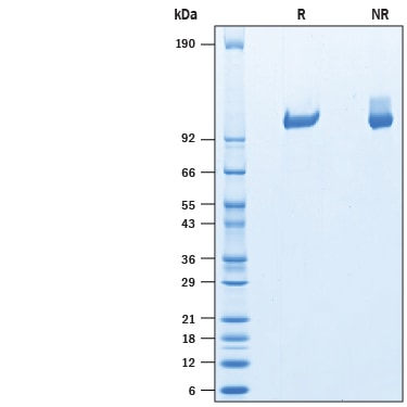Recombinant Human Tie-2 His-tag Protein SDS-PAGE