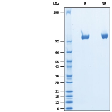 Recombinant Rat Tie-2 His-tag Protein SDS-PAGE