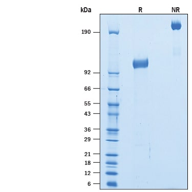Recombinant Mouse TrkB Fc Chimera Protein SDS-PAGE
