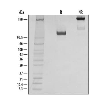 Recombinant Human TrkB Fc Chimera Protein SDS-PAGE