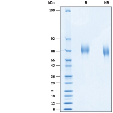 Recombinant Human Tyro3/Dtk His-tag Protein SDS-PAGE