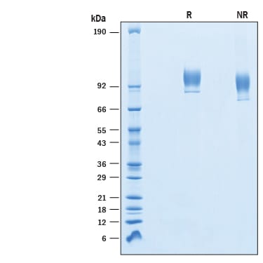 Recombinant Human VCAM-1/CD106 His-tag Protein SDS-PAGE