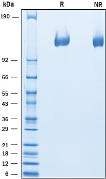 Recombinant Mouse VEGFR2/Flk-1 His-tag Protein SDS-PAGE