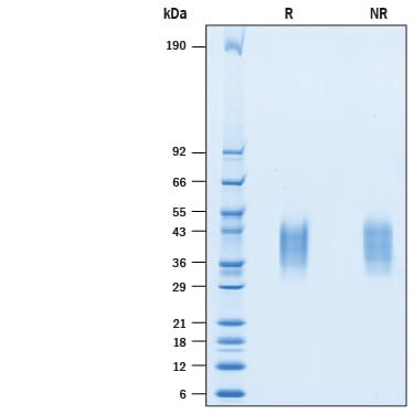 Recombinant Cynomolgus VISTA/B7-H5/PD-1H His-tag Protein SDS-PAGE