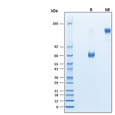Recombinant Human VISTA/B7-H5/PD-1H Fc Avi-tag Protein SDS-PAGE
