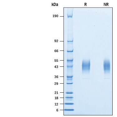 Recombinant Human VISTA/B7-H5/PD-1H His Avi-tag Protein SDS-PAGE