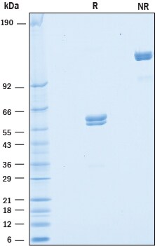 Recombinant Human VSIG2 Fc Chimera Protein SDS-PAGE