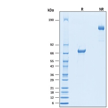 Recombinant Cynomolgus Monkey VSIG4 Fc Chimera Protein SDS-PAGE