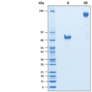 Recombinant Human VSIG4 Fc Chimera Avi-tag Protein SDS-PAGE