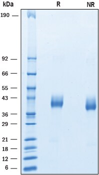 Recombinant Human VSTM2A His-tag Protein SDS-PAGE