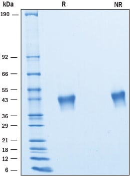 Recombinant Human VSTM2B His-tag Protein SDS-PAGE
