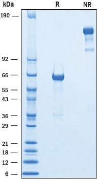 Recombinant Mouse VSTM2B Fc Chimera Protein SDS-PAGE