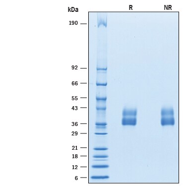 Recombinant Mouse VSTM4 His-tag Protein SDS-PAGE