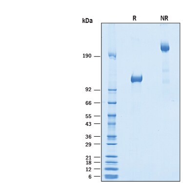 Recombinant Human Vasorin/SLIT-like 2 Fc Chimera Protein SDS-PAGE