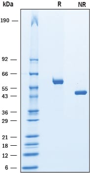 Recombinant Human Vitamin D BP His-tag Protein SDS-PAGE