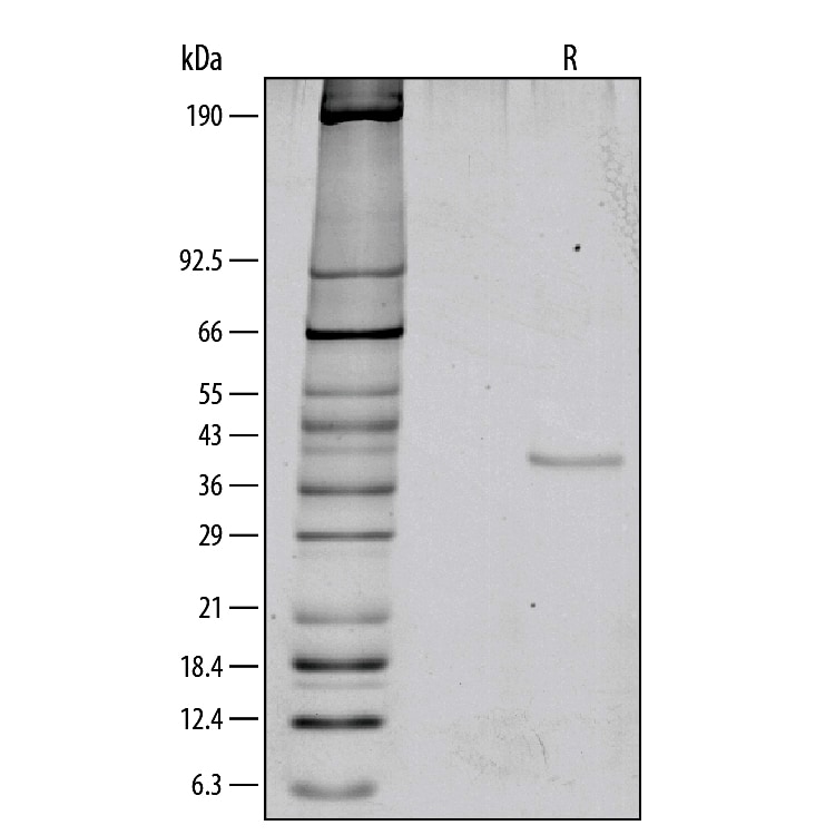 Recombinant Human Wnt-3a (High Purity) Protein SDS-PAGE