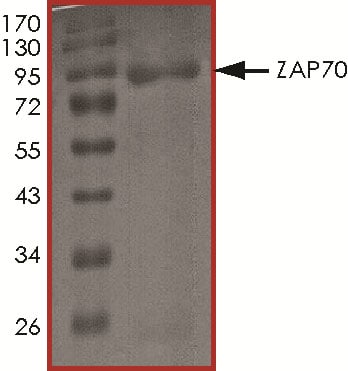Recombinant Human Active ZAP70 Protein SDS-PAGE