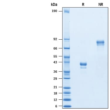 Recombinant Human BCMA/TNFRSF17 Protein, Atto 647N Conjugate SDS-PAGE
