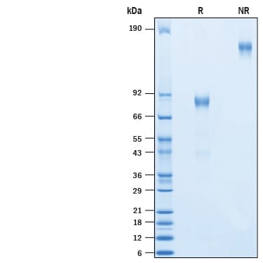 Recombinant Human CD19 Protein, Atto 647N Conjugate SDS-PAGE