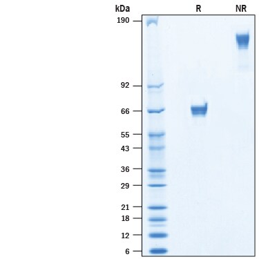 Recombinant Human VSTM2B Fc Chimera Avi-tag Protein SDS-PAGE