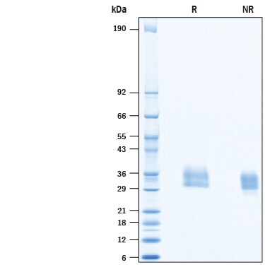 Recombinant Human ULBP-2 His-tag Avi-tag Protein SDS-PAGE