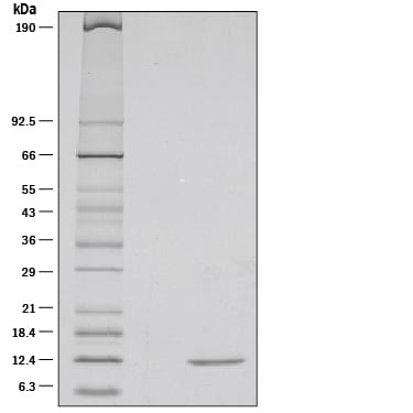 Recombinant Rat beta-NGF Protein SDS-PAGE