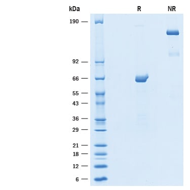 Recombinant Human epsilon-Sarcoglycan Fc Chimera Protein SDS-PAGE