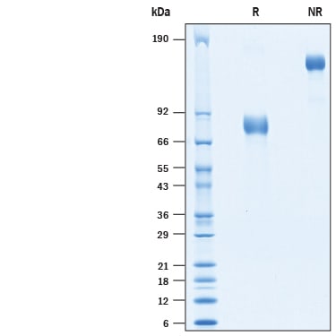 Recombinant Human uPAR Fc Chimera Protein SDS-PAGE