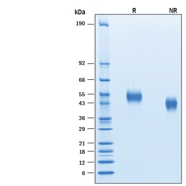 Recombinant Human uPAR His-tag Avi-tag Protein SDS-PAGE