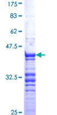 SDS-PAGE: Recombinant Human Cdc20 GST (N-Term) Protein [H00000991-Q01]