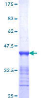 SDS-PAGE: Recombinant Human CENPF GST (N-Term) Protein [H00001063-Q01]