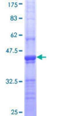 SDS-PAGE: Recombinant Human Clathrin Heavy Chain 1/CHC17 GST (N-Term) Protein [H00001213-Q01]