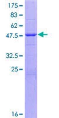 SDS-PAGE: Recombinant Human Casein GST (N-Term) Protein [H00001446-P01]